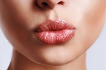 Aumento de labios con ácido hialurónico