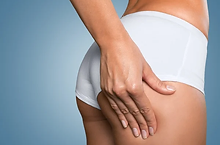 Liposucción con injerto a glúteo en cirugía plástica