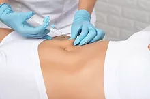 Tratamiento de lipo sin bisturí para reducción abdominal